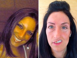 Wanita Ini Cari Pengobatan untuk Kembalikan Wajahnya yang Runtuh Separuh