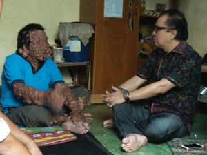 Tantowi Yahya Kunjungi Urip, Siap Bantu Pengobatan ke RS Tantowi Yahya Kunjungi Urip, Siap Bantu Pengobatan ke RS