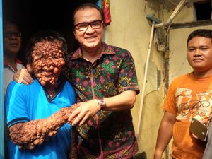 Bantu Operasi Pak Urip, Tantowi: Niat Baik Saya Terlaksana