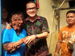 Bantu Operasi Pak Urip, Tantowi: Niat Baik Saya Terlaksana