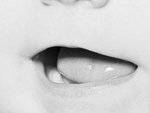 Tak Selalu karena Tongue Tie, Puting Lecet Juga Bisa karena Sebab Lain Tak Selalu karena Tongue Tie, Puting Lecet Juga Bisa karena Sebab Lain