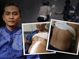 Kami Tidak Trauma, Kisah Para Polisi Korban Teror yang Hidup Kembali Kami Tidak Trauma, Kisah Para Polisi Korban Teror yang Hidup Kembali
