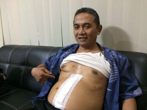Cerita Aiptu Budiono Soal Raut Wajah Pelaku Teror Saat Menembaknya