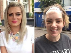 Dikira Pusing Karena Urus 4 Anak, Wanita Ini Ternyata Punya Tumor Otak