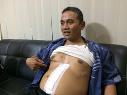 Paru-paru Diserempet Peluru, Aiptu Budiono Kini Jauhi Kopi dan Rokok
