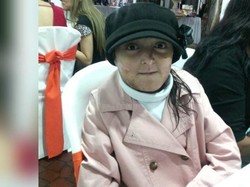 Akhir Kisah Jessica, Gadis dengan Kulit Serapuh Sayap Kupu-kupu