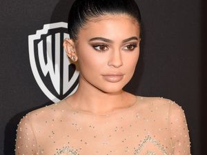 Dokter Kecantikan Indonesia: Filler Bibir Kylie Jenner Tren yang Negatif