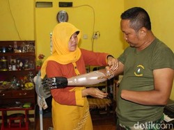 Tangan Bionik Memberi Harapan Baru Bagi Keluarga Serka Siswandi
