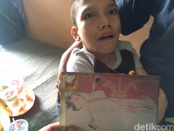 Disebut Mengalami Radang Otak, Apa Sebenarnya Penyakit Fahmi?