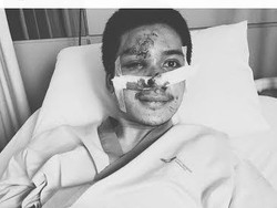 Jejak Arsha Algadri: Gigit Hidung Reiner, Menghilang dan Menyerah ke Polisi