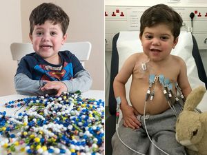 Kisah Oliver yang Harus Jalani Ribuan Prosedur untuk Bisa Bertahan Hidup