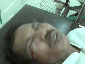 Paman Tertembak Senapan Angin Saat Gendong Balita