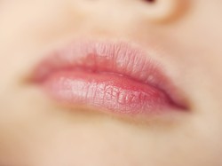 Sadis, Bibir Wanita Ini Nyaris Putus Digigit Mantan Pacar yang Posesif