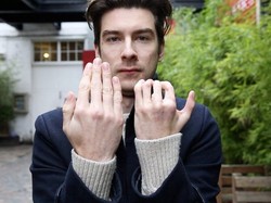 Pria ini Kebanjiran Peran di Teater Karena Kondisi Langka pada Tangannya