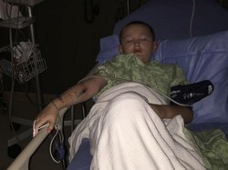 Idap Kelainan Langka, Kulit Bocah 10 Tahun Ini Mengeras Seperti Batu