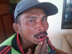 Buruh Tani Lapor Polisi karena Dianiaya dan Ditodong Pengusaha