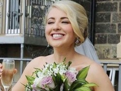 Bahu Nyeri Dikira Salah Otot, Ternyata Clare Kena Kanker Kulit