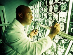 Stroke Ada Dua Jenis, Yuk Kenali Bedanya