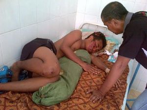Remaja ini Luka Usai Dipukul Tongkat Polisi