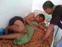 Remaja ini Luka Usai Dipukul Tongkat Polisi