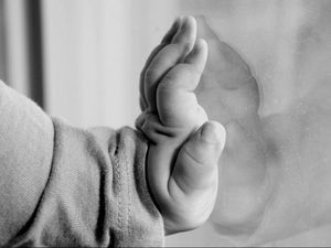 Jika Mengalami Cacat Lahir, Bayi Diusulkan Langsung Donorkan Organnya Jika Mengalami Cacat Lahir, Bayi Diusulkan Langsung Donorkan Organnya