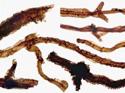 Filamen Jamur ini Disebut Sebagai Fosil Organisme Darat Tertua di Dunia