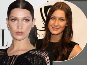 Hidung Lebih Mancung Dibanding 6 Tahun Lalu, Bella Hadid Dituduh Operasi