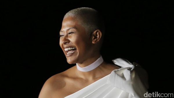 Botak, Dira Sugandi Tetap Kece!