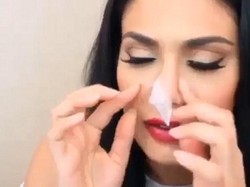 Bahaya yang Bisa Terjadi Pada Kulit Saat Angkat Komedo Pakai Lem