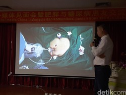 Pasien Diabetes Ringan dan Obesitas, Disarankan Tidak Jalani Bypass Lambung?