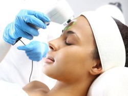 Beragam Jenis Metode Menghilangkan Jerawat, Mana yang Paling Efektif?