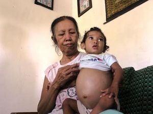 Cinta, Balita Pengidap Tumor Perut Banyuwangi Dirujuk ke RSSA Malang