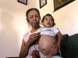 Balita Penderita Tumor Perut Akan Dirujuk ke RSU Soetomo