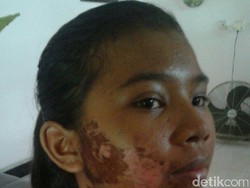 Dianiaya Majikan, PRT Mengadu ke Polres Jakut