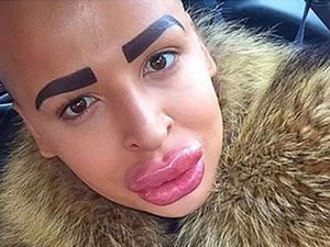 Foto: Alis dengan Bentuk Teraneh, Alis Nyambung Hingga Ada Empat