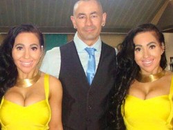 Terlalu Kompak, Kembar Identik Ini Berbagi Tempat Tidur Hingga Pacar