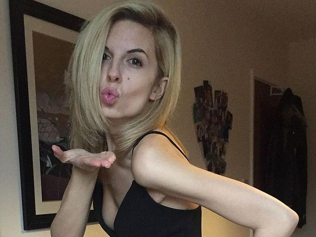 Usia 23 Beratnya Hanya 38 Kg, Hayley Sembuh dari Anoreksia karena Instagram Usia 23 Beratnya Hanya 38 Kg, Hayley Sembuh dari Anoreksia karena Instagram