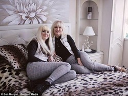 Terobsesi Mirip Anaknya, Wanita Ini Operasi Plastik Hingga Rp 748 Jutaan