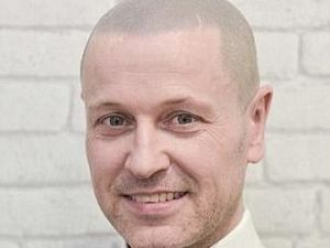 Berkat Tato, Simon yang Dulunya Botak Kini Punya Rambut dan Kembali Pede