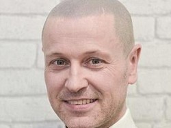 Berkat Tato, Simon yang Dulunya Botak Kini Punya Rambut dan Kembali Pede