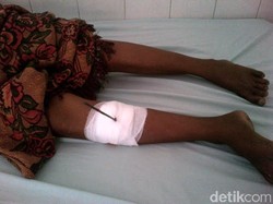 Seorang Ibu di Situbondo Ambruk Terkena Panah Orang Tak Dikenal