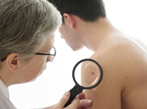 Ingin Hilangkan Tahi Lalat? Simak Dulu Saran Dokter Berikut Ini Ingin Hilangkan Tahi Lalat? Simak Dulu Saran Dokter Berikut Ini