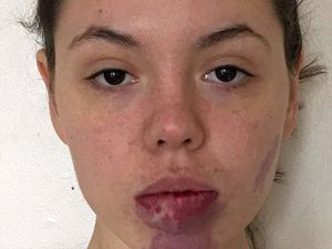 Model Ini Percaya Diri Tunjukkan Wajah dengan Tanda Lahir yang Besar