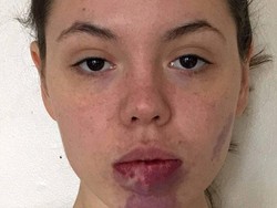 Model Ini Percaya Diri Tunjukkan Wajah dengan Tanda Lahir yang Besar