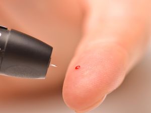 Ini Pemeriksaan Kesehatan Bagi Pria Berdasarkan Usia