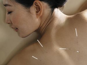 Kecelakaan Akupuntur, Paru-paru Wanita Ini Kolaps Tertusuk Jarum