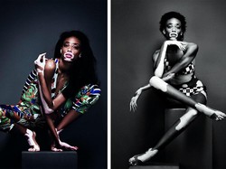 7 Wanita Dengan Kondisi Lumpuh Hingga Kulit Belang yang Sukses Jadi Model