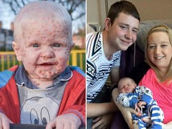 Cacar Air di Sekujur Tubuh Oscar Ini Muncul karena Sakit Imun Langka