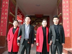 Kembar Identik Ini Harus Operasi Plastik Agar Bisa Dikenali Pasangannya