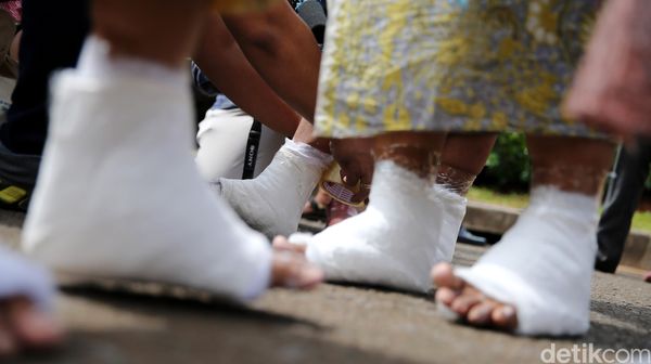 Aksi Membeton Kaki di Depan Istana